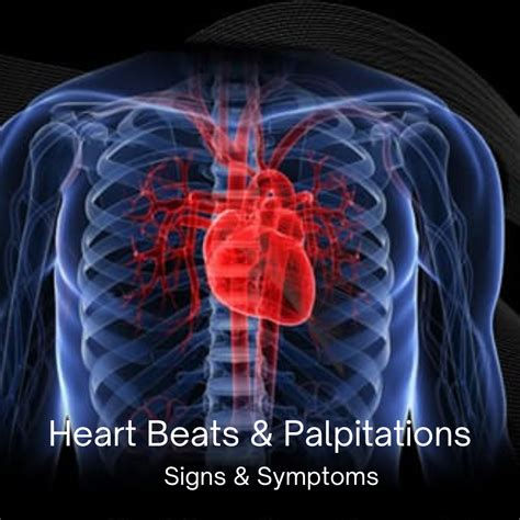 orla palpit|Palpitations: Symptoms, Causes, and Treatment .